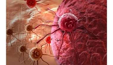 medžiaga blokuoja vėžio metastazių plitimą